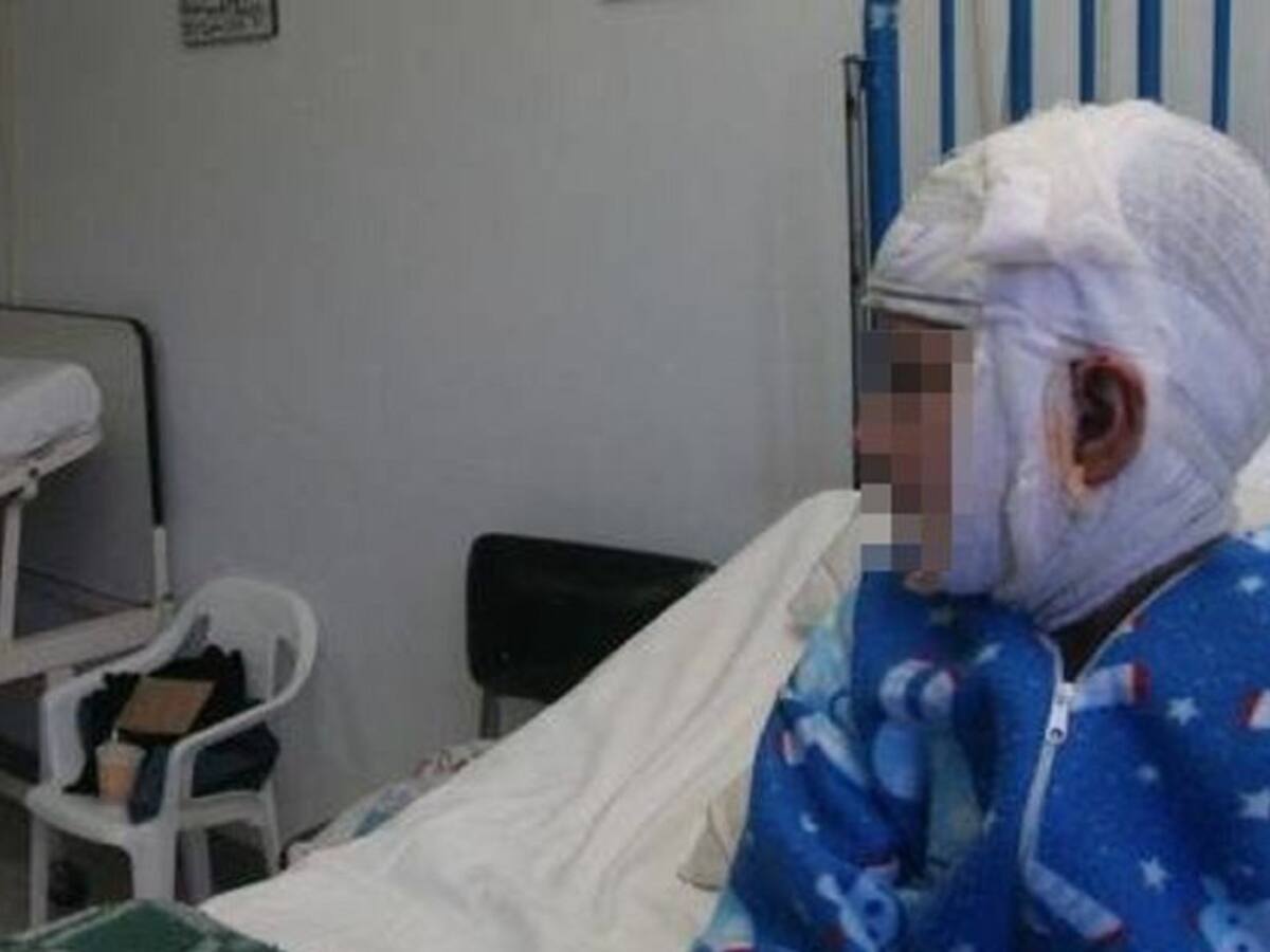 Menor con quemaduras por caída de cable de alta tensión pide ayuda