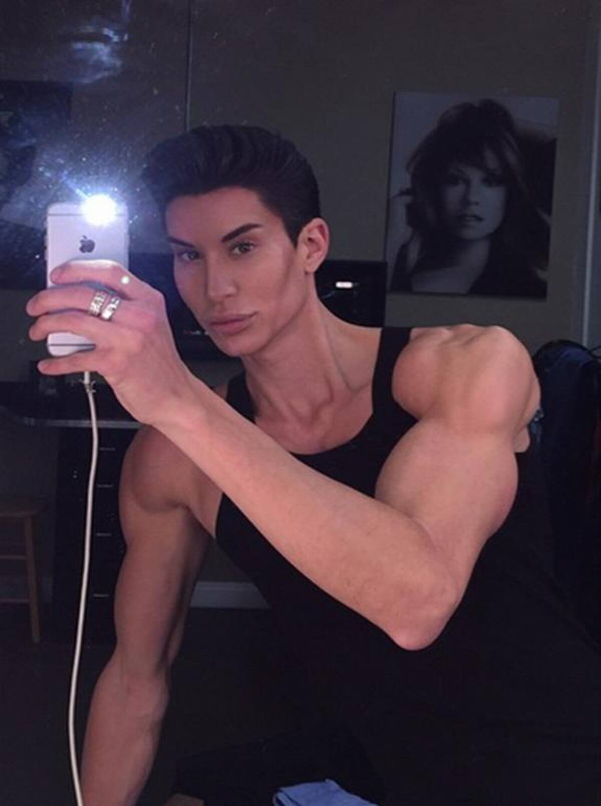 Justin Jedlica se operó para remover tres venas de su frente, intervención que lo pudo dejar ciego. Fotos: Instagram.