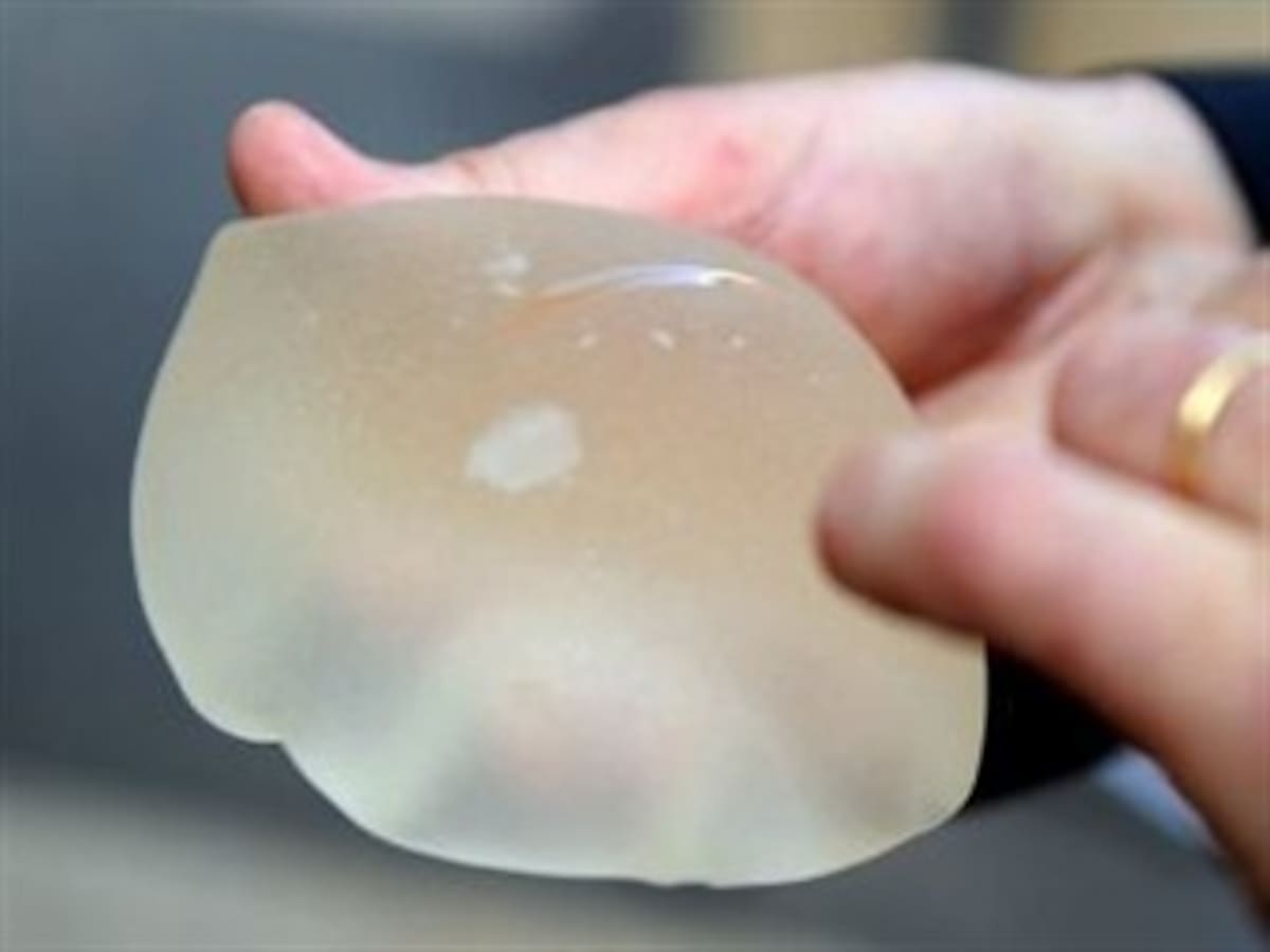 Detienen en España a panameña con prótesis mamarias rellenas de cocaína