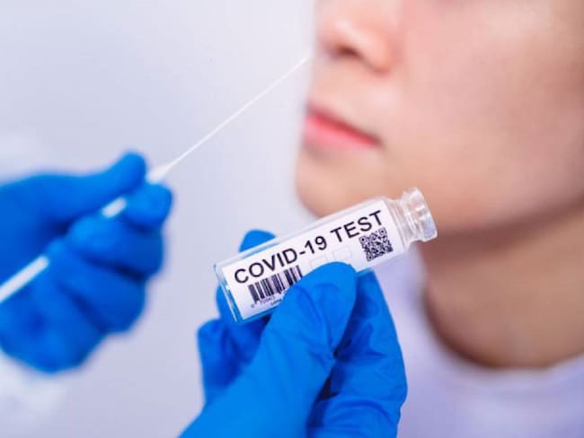 Testeos masivos Coronavirus