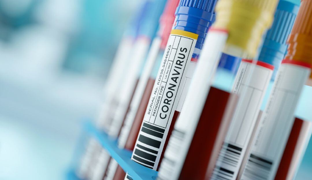 Minsalud confirmó este lunes 18 de enero 14.719 nuevos casos de covid-19 en Colombia, de los cuales 1349 pertenecen al Valle.