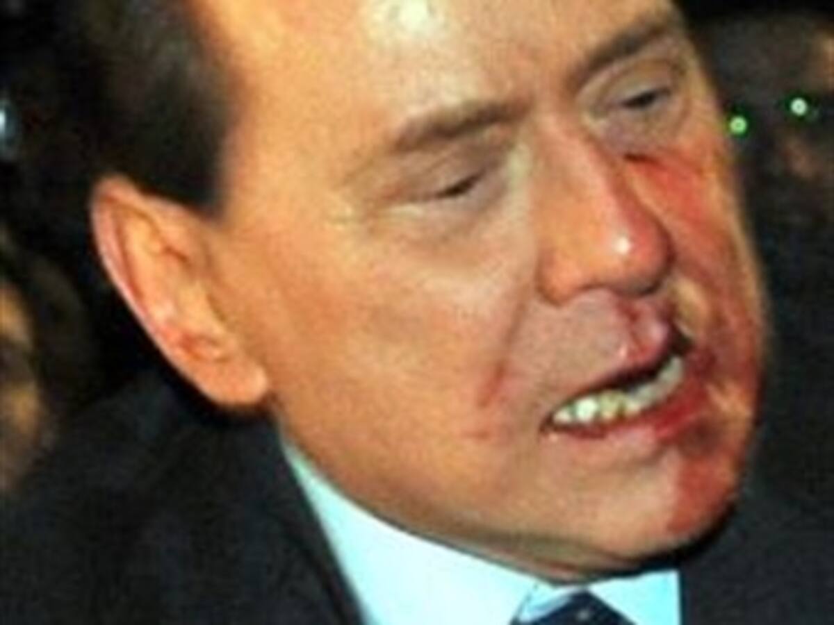 Berlusconi, operado en la cara por las secuelas de la agresión en Milán