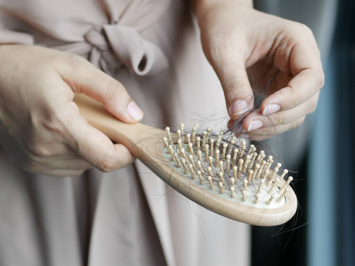 ¿Qué significa cuando se cae demasiado el cabello? Así puede saber si es por estrés