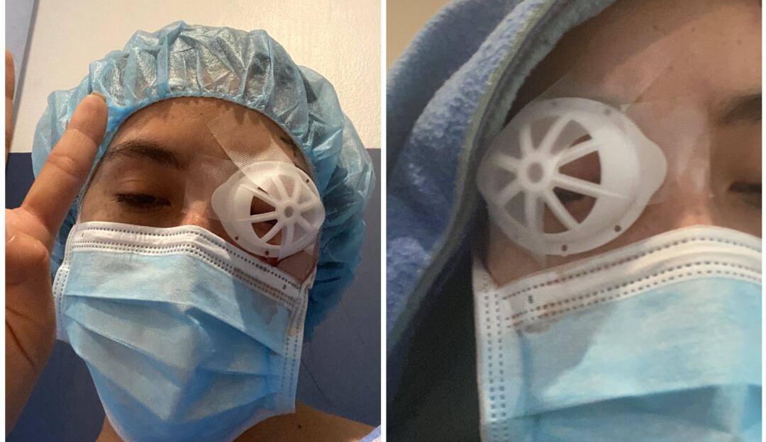 Leidy Cadena, la mujer que perdió un ojo durante marchas del 28 de abril