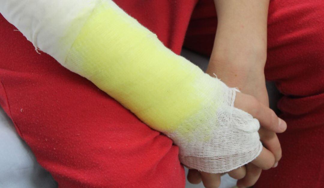 Quemados con pólvora