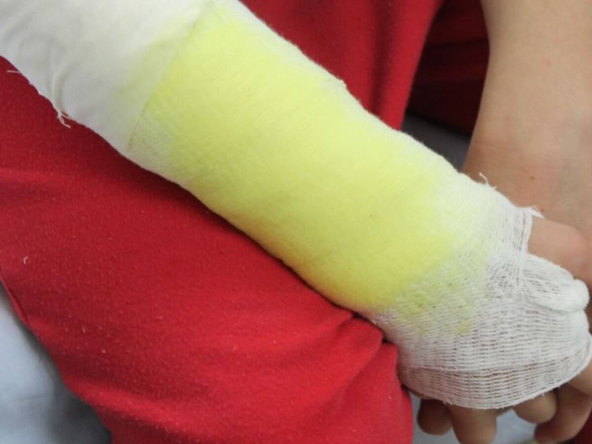 Gobierno de Caldas continúa lucha contra el uso de la pólvora