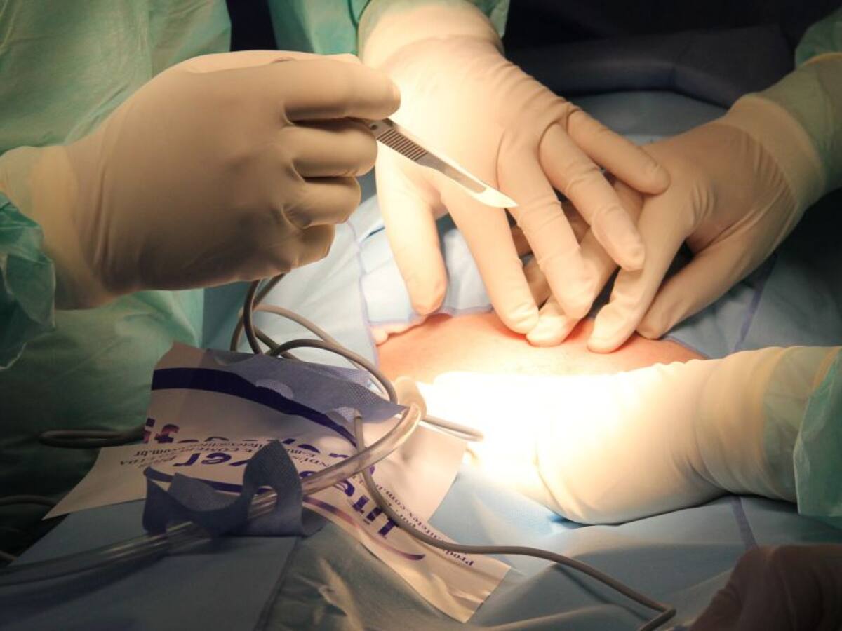 Médico y 2 enfermeras judicializados por muerte de paciente en cirugía