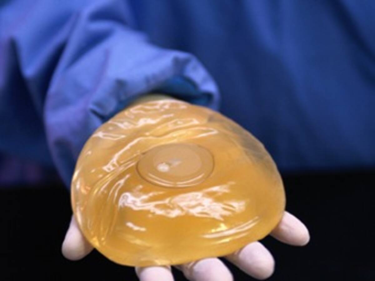 Más de 30 mil mujeres podrían tener implantes defectuosos en Francia