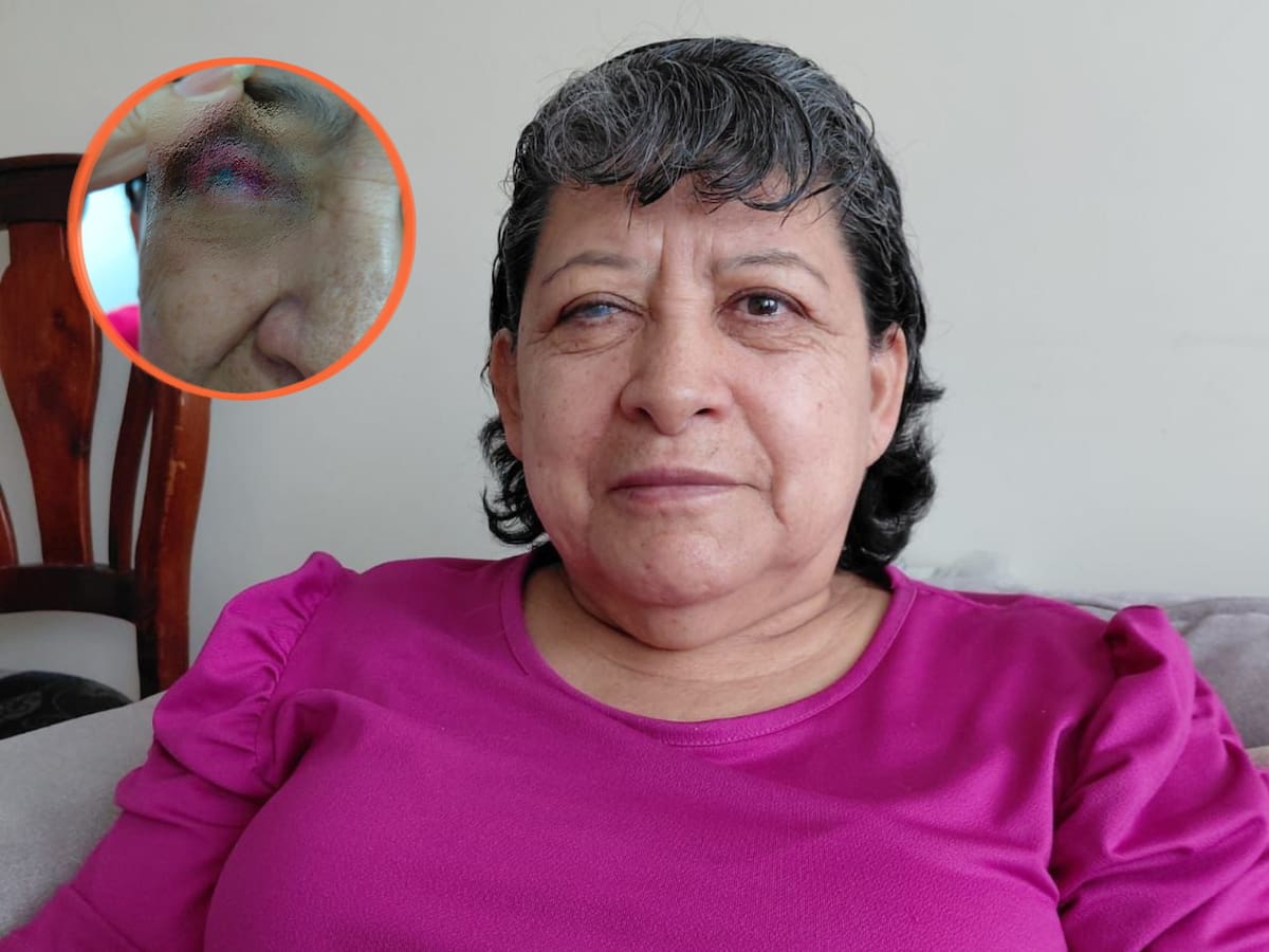 Mujer de 68 años denuncia haber perdido la visión de uno de sus ojos por presunta negligencia de EPS