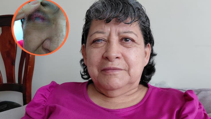 Mujer de 68 años denuncia haber perdido la visión de uno de sus ojos por presunta negligencia de EPS