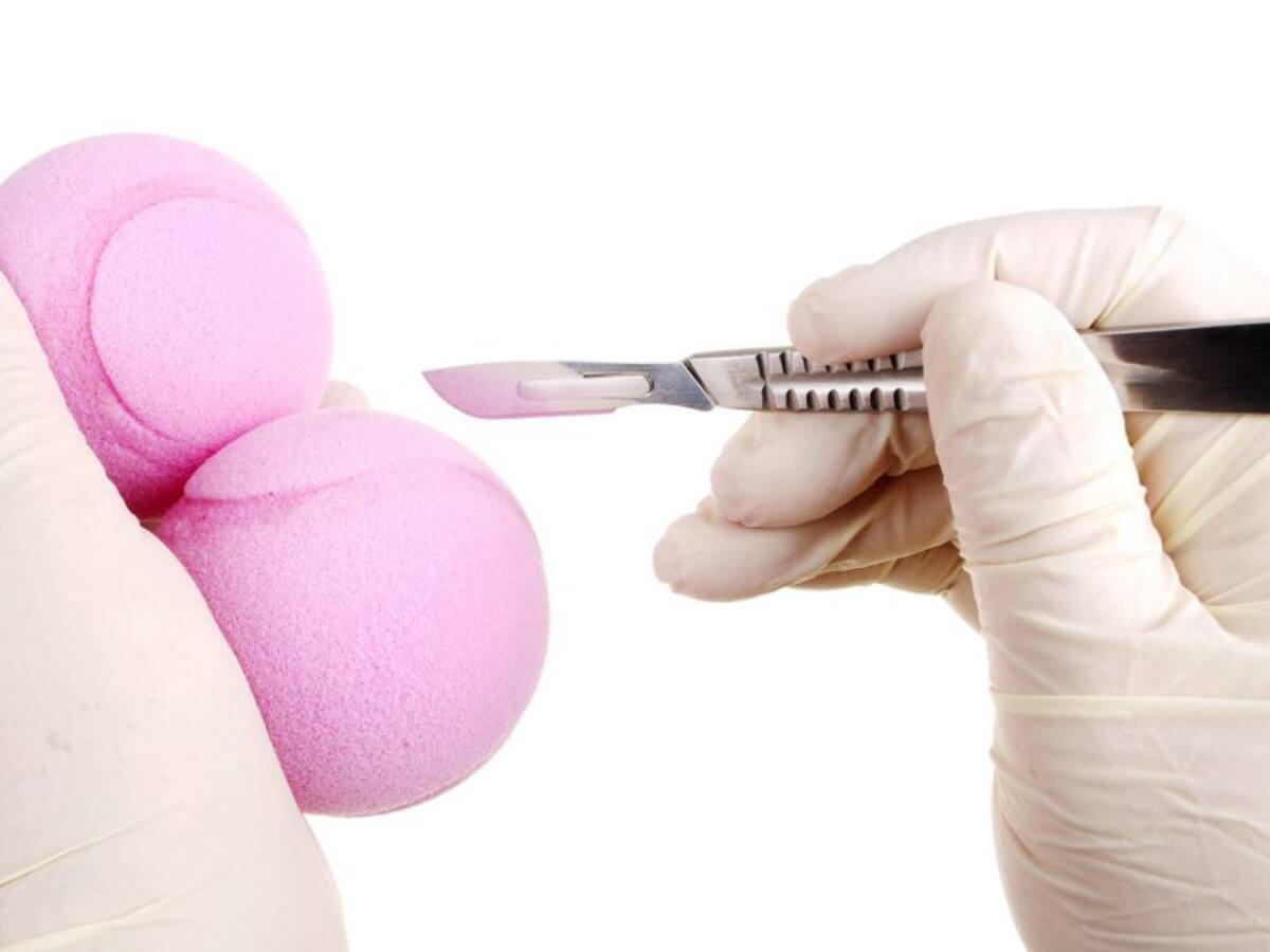 Un estudio sugiere que los hombres castrados podrían vivir más tiempo