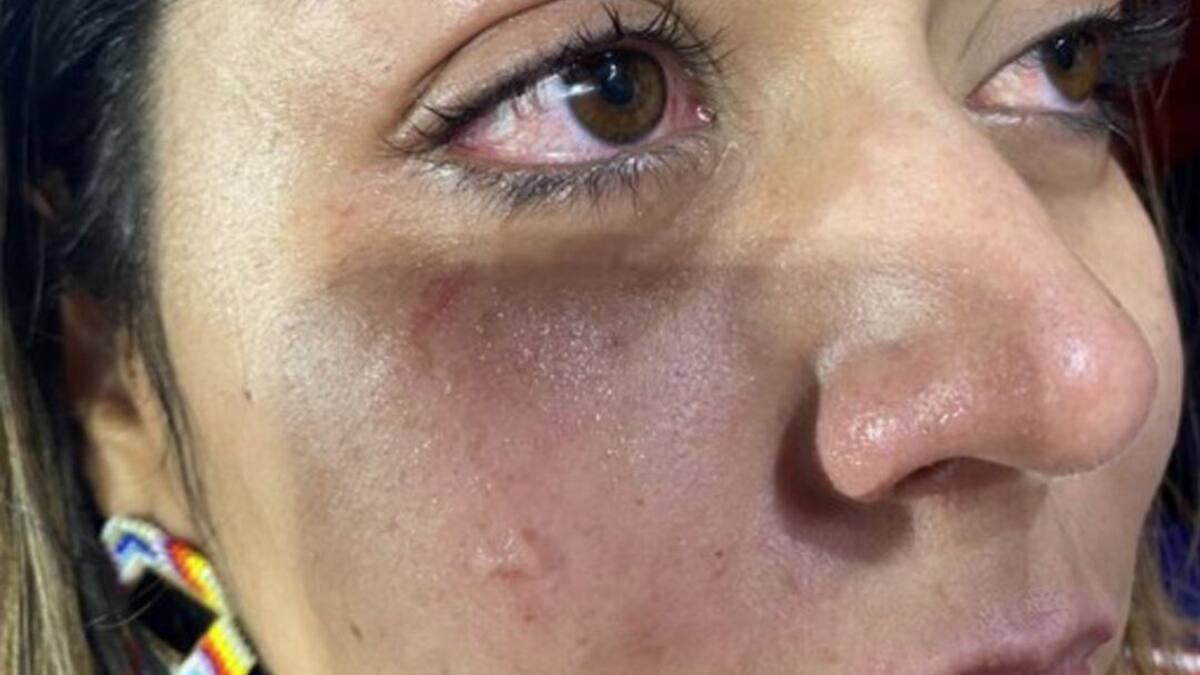 Mujer denunció agresión física en una de las tribunas del Pascual Guerrero