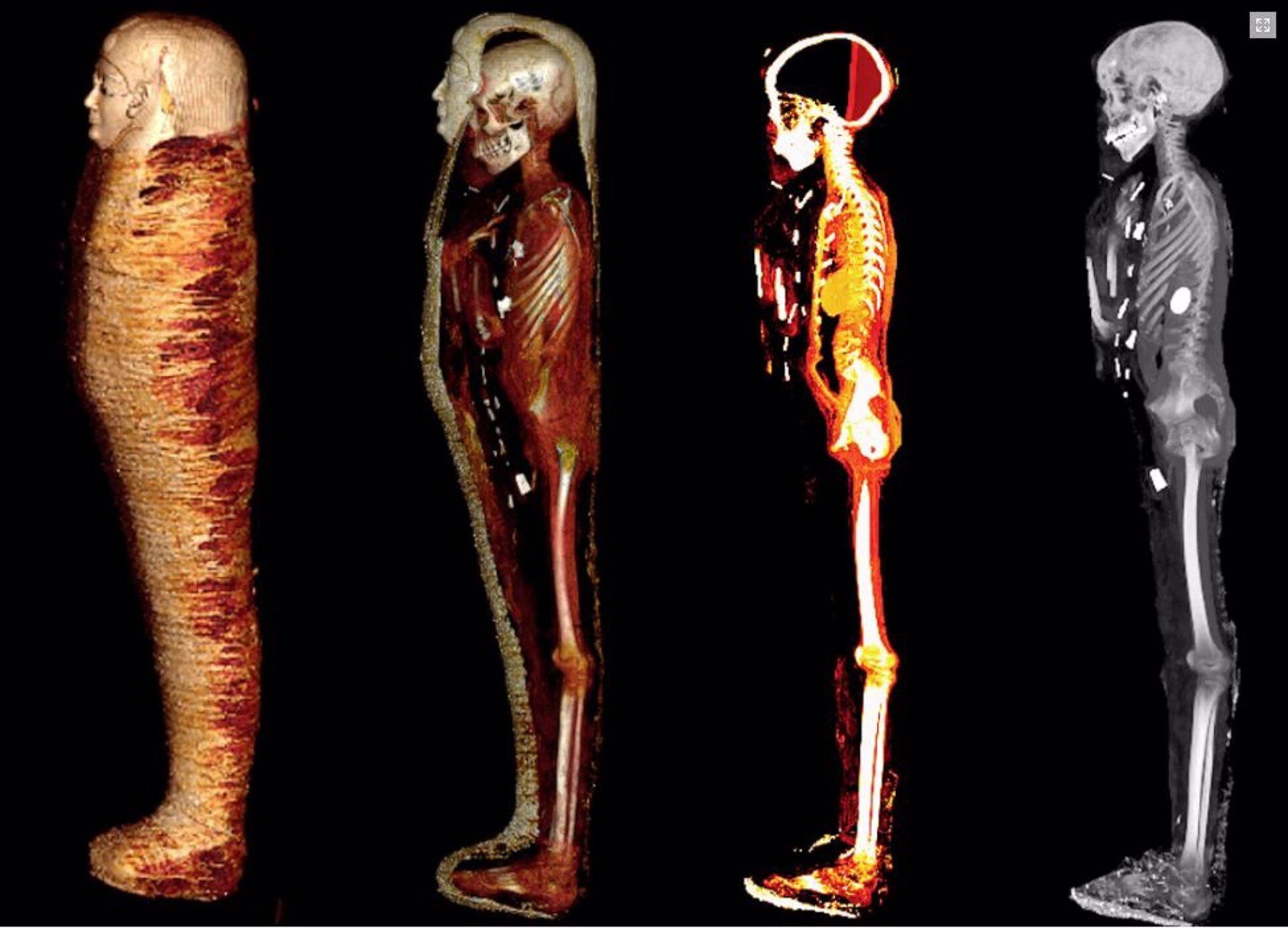 El "chico de oro" desenvuelto digitalmente, paso a paso - SN SALEEM, SA SEDDIK, M EL-HALWAGY - EUROPA PRESS