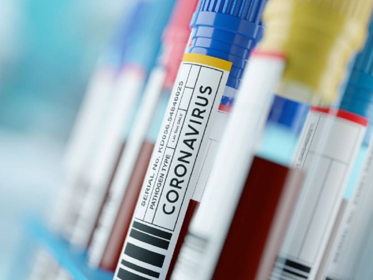 Cali inicia vacunación contra la COVID-19 para personas mayores de 40 años