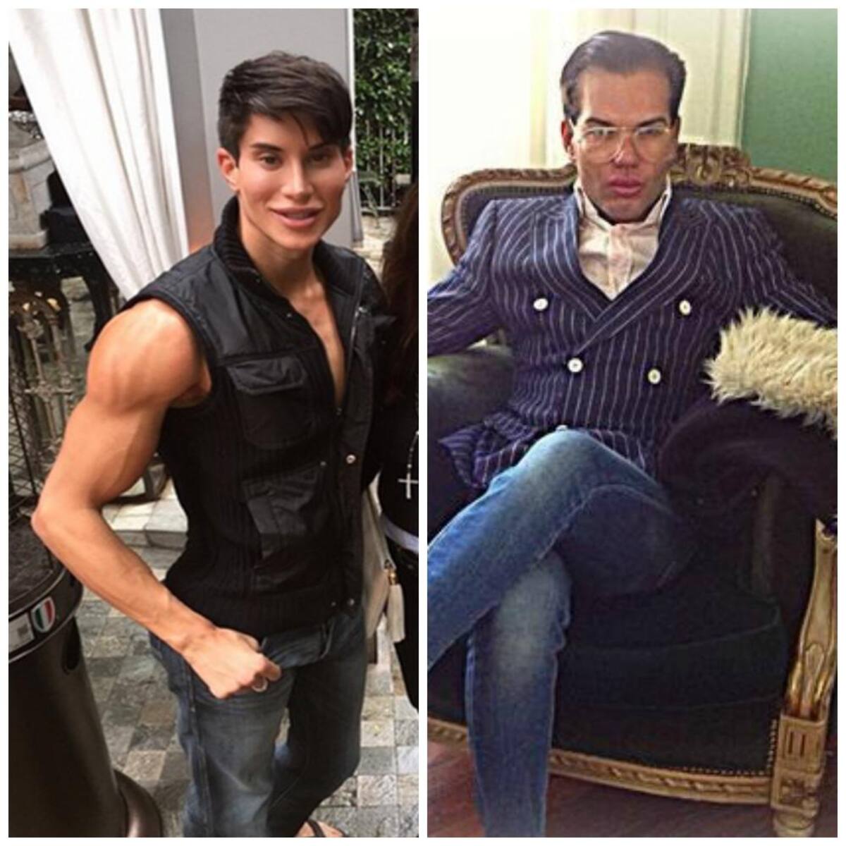 Los dos se han hecho varias cirugías plásticas para parecerse al novio de Barbie. Usted decide cuál está logrando su cometido.