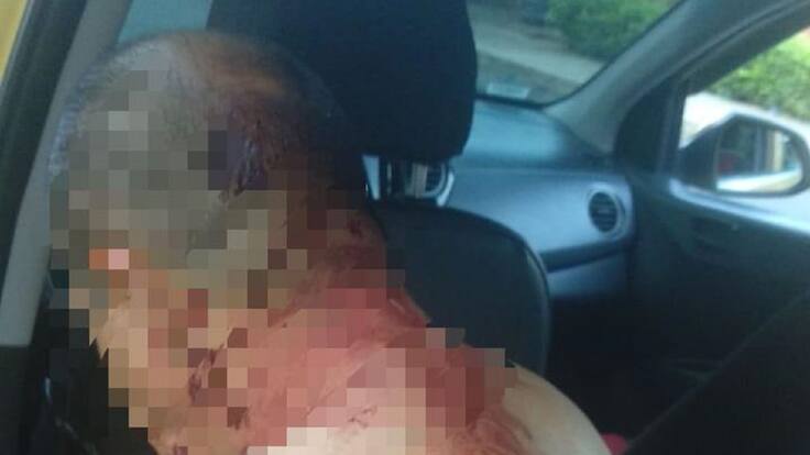Taxista fue herido en atraco al norte de Bucaramanga