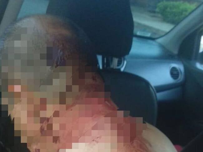 Taxista fue herido en atraco al norte de Bucaramanga