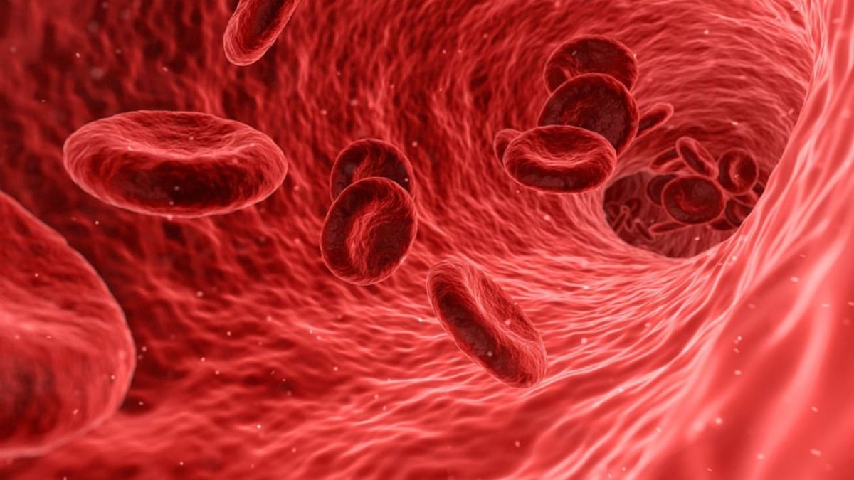 Síntomas y riesgos del ataque cerebrovascular.