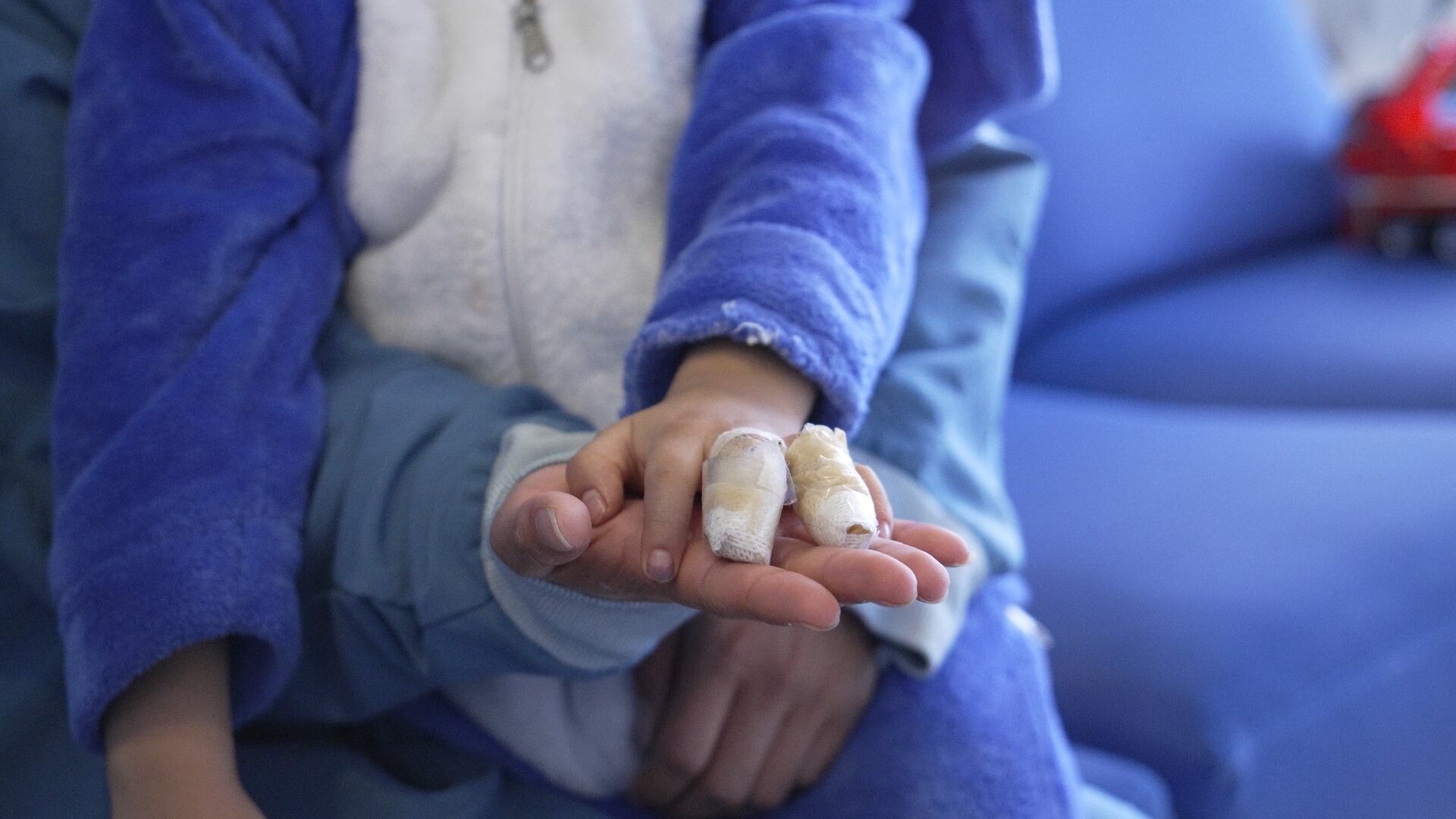 ‘Hay recuerdos que no se borran’: Bogotá refuerza alerta tras 146 heridos por pólvora el año pasado