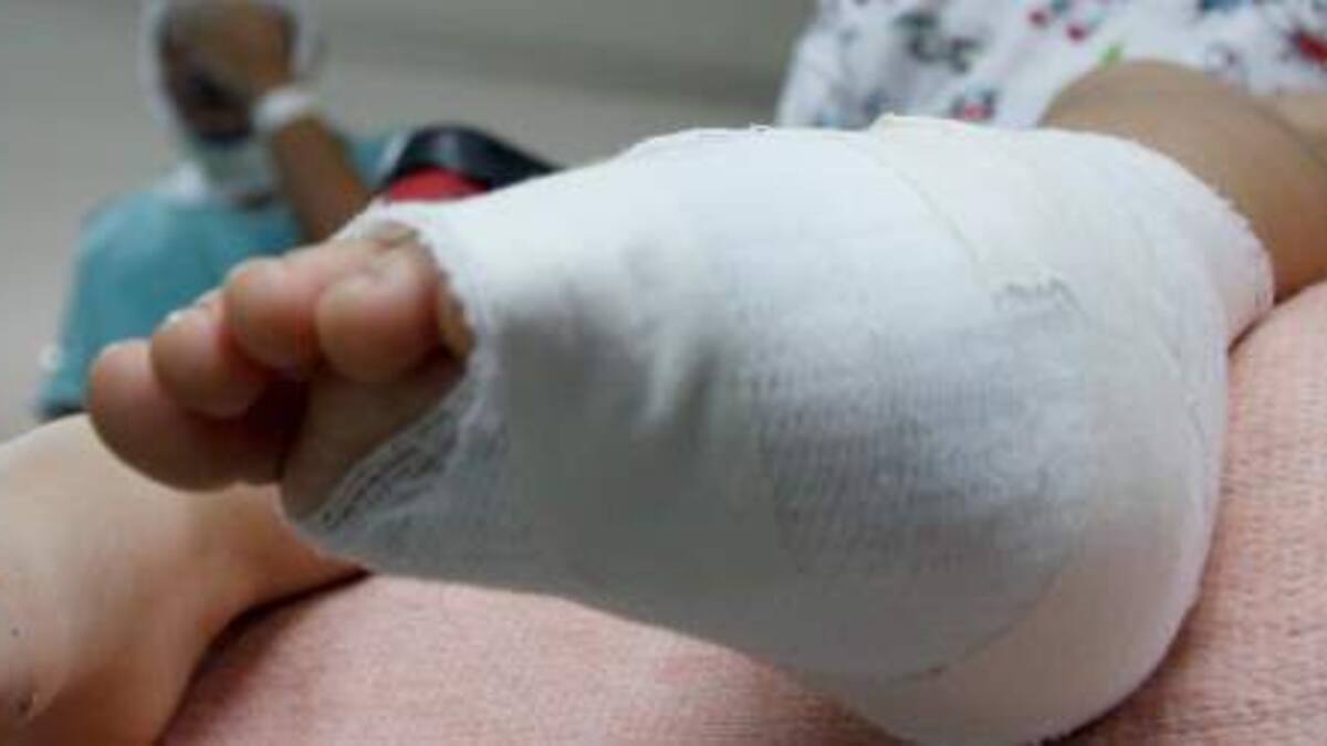 Dos niñas heridas en explosión fueron trasladadas a Bucaramanga