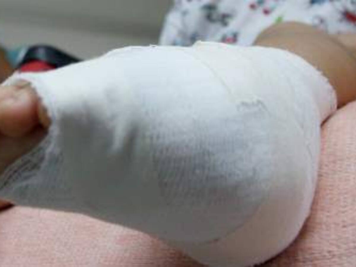 Dos niñas heridas en explosión fueron trasladadas a Bucaramanga