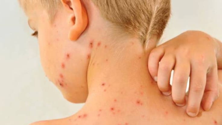 Secretario de Salud de Santander, Edwin Prada