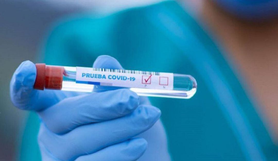 La variante Delta tiene una alta carga viral, lo que la hace mucho más fácil de transmitir y con un riesgo alto de derivación a UCI.