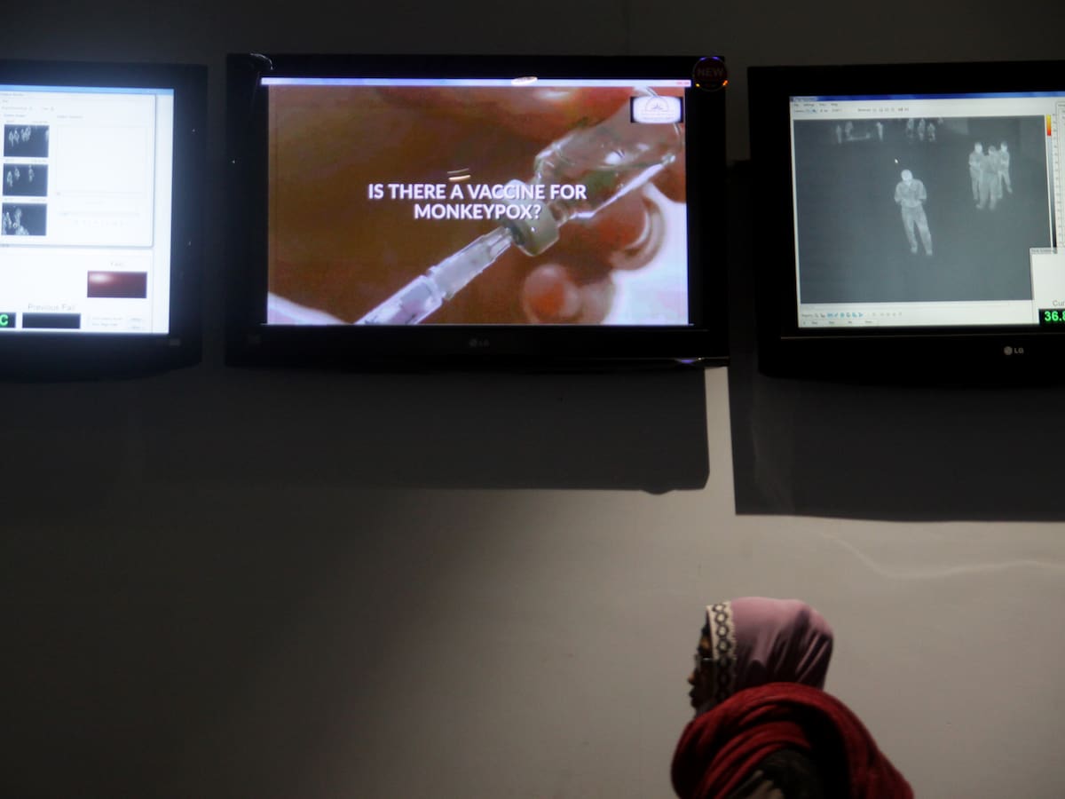 MinSalud analiza caso de hombre procedente de España contagiado de viruela del mono