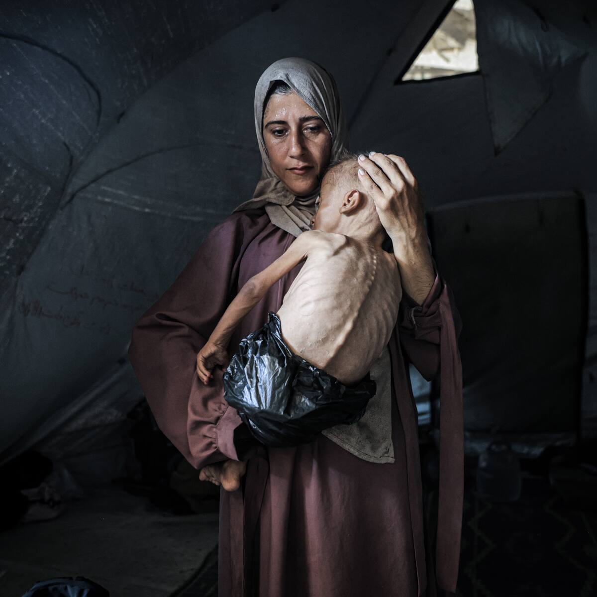 Guerra en Gaza: 150 niños han muerto por hambre