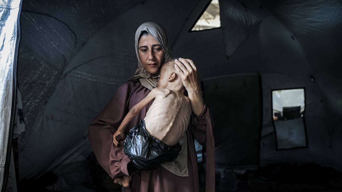 Guerra en Gaza: 150 niños han muerto por hambre