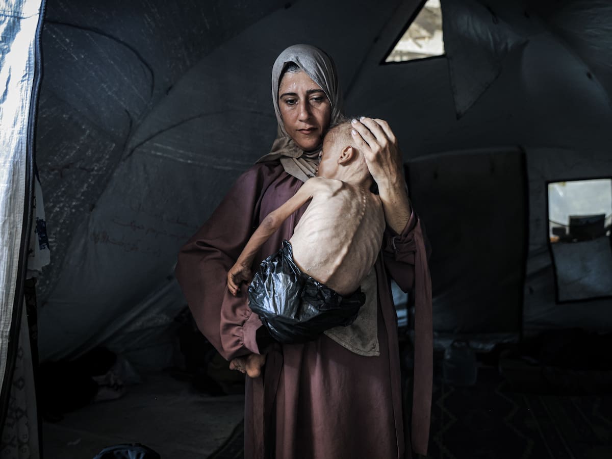 Guerra en Gaza: 150 niños han muerto por hambre