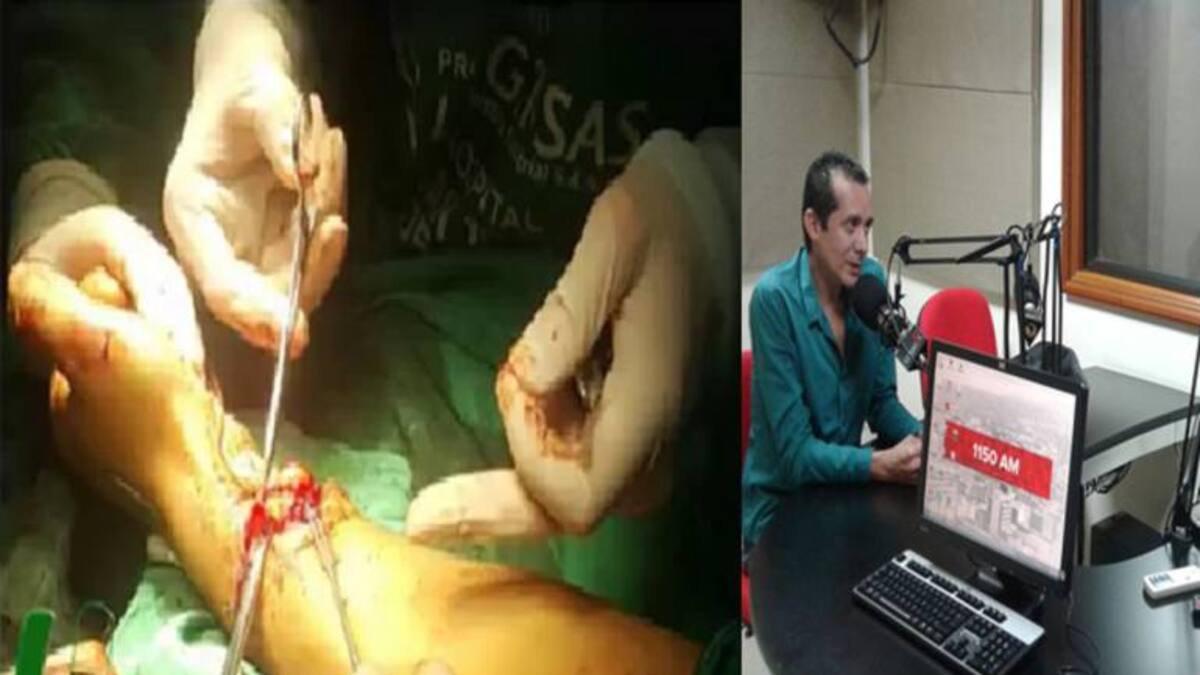 Cirujanos en el Quindío realizan con éxito re implante de mano a trabajador del campo