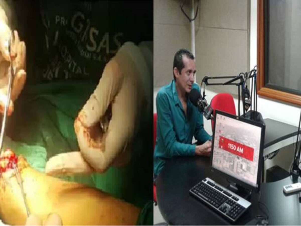 Cirujanos en el Quindío realizan con éxito re implante de mano a trabajador del campo