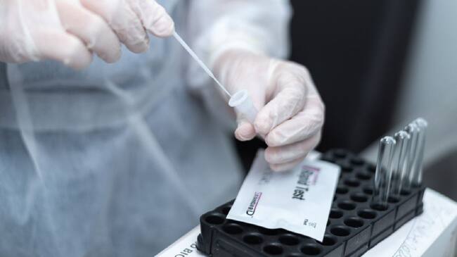 Usuarios que reúnan los criterios del Ministerio podrán acercarse este jueves de 8 a 11 de la mañana, al centro comercial La Plazuela.