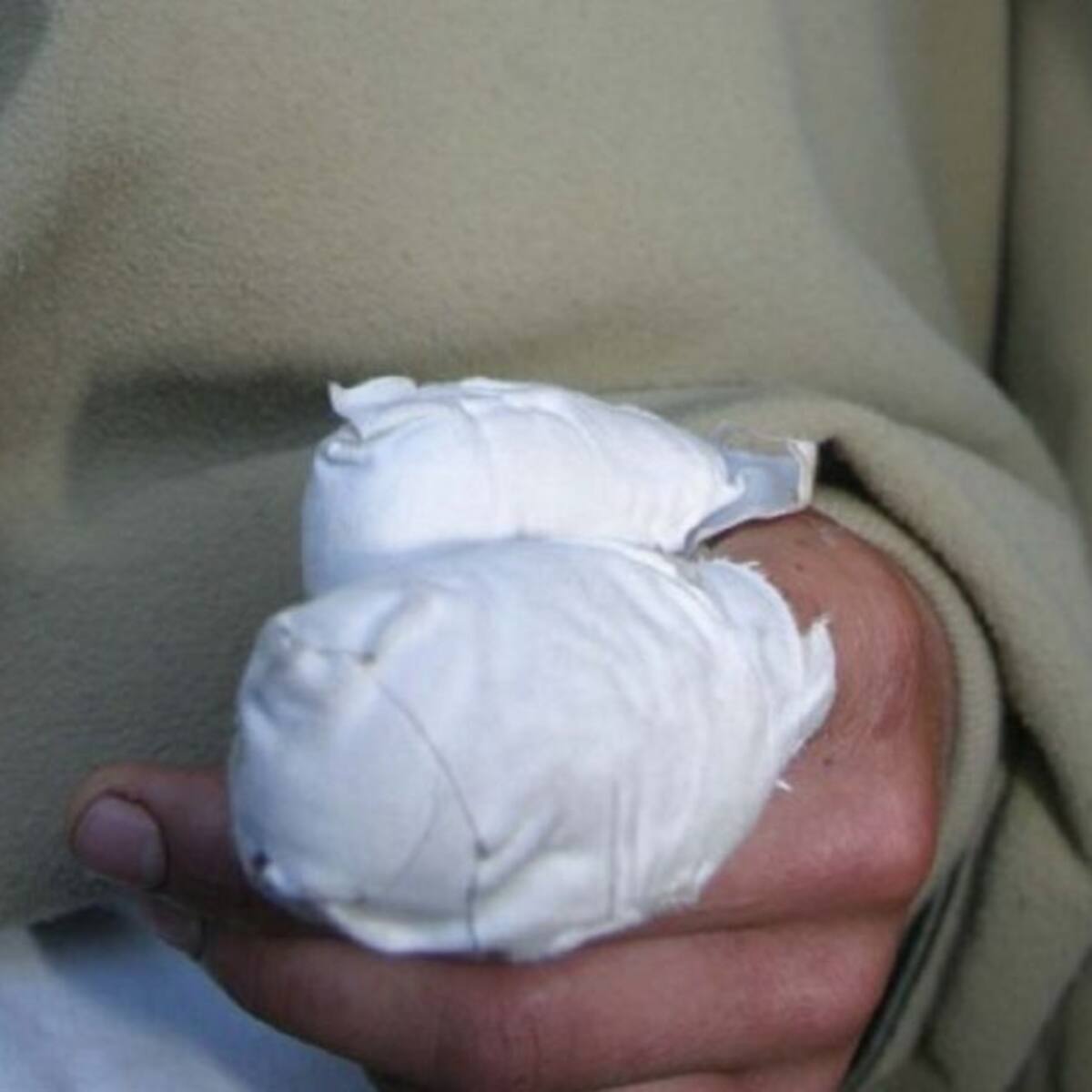 El primer quemado con pólvora en Boyacá, se registró el día de las velitas