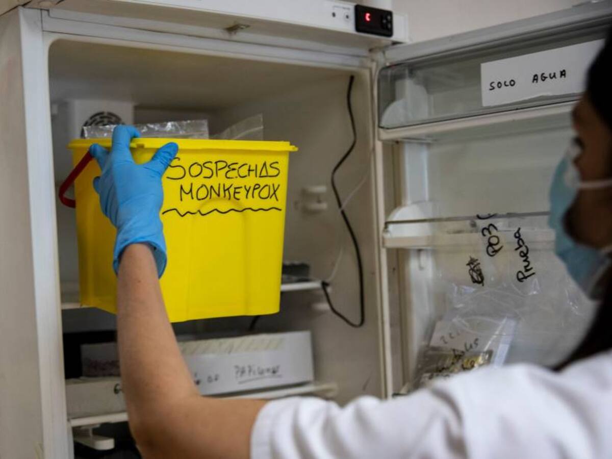 OMS elimina distinción de países endémicos y no endémicos con viruela del mono