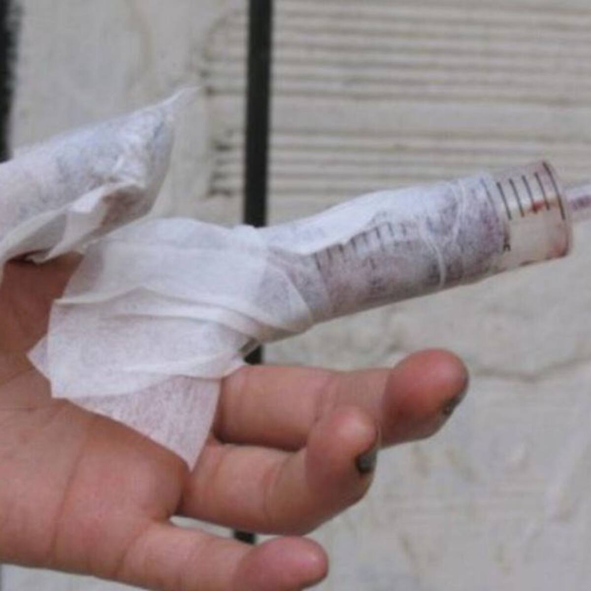 Dos nuevos quemados con pólvora elevan la cifra a 41 en Antioquia