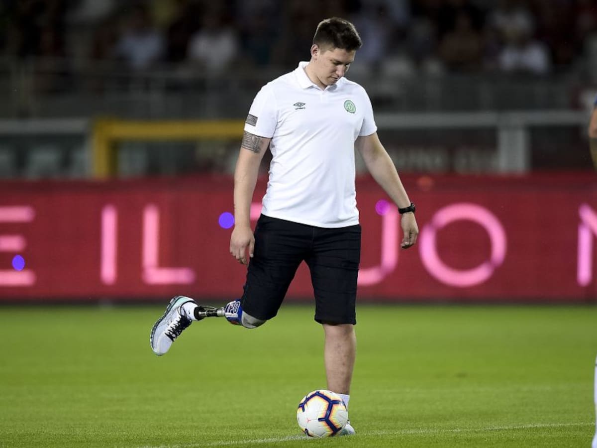 Un poco crúel: sobreviviente de Chapecoense se burló por su pierna amputada