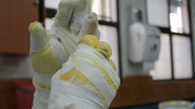 Crónica: consecuencias del uso de la pólvora