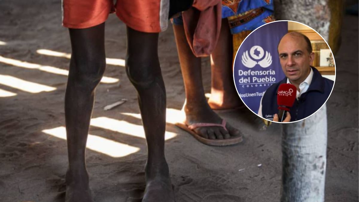La Defensoría del Pueblo alerta por muertes de menores por desnutrición en La Guajira