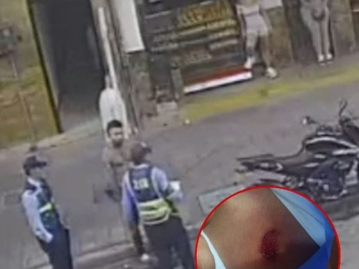 Agente de tránsito en Armenia lesionado con arma traumática por conductor de moto mal parqueada