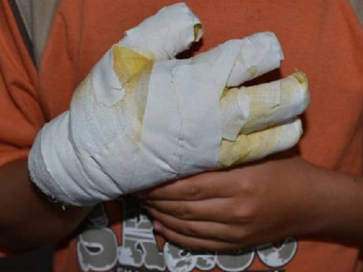 Gobierno caleño y Personería hacen llamado a no utilizar Pólvora