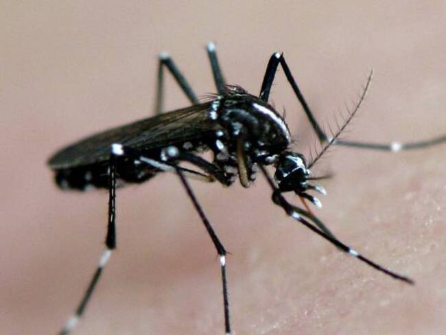 Ministro de Salud entrega preocupante cifra de microcefalia en Colombia