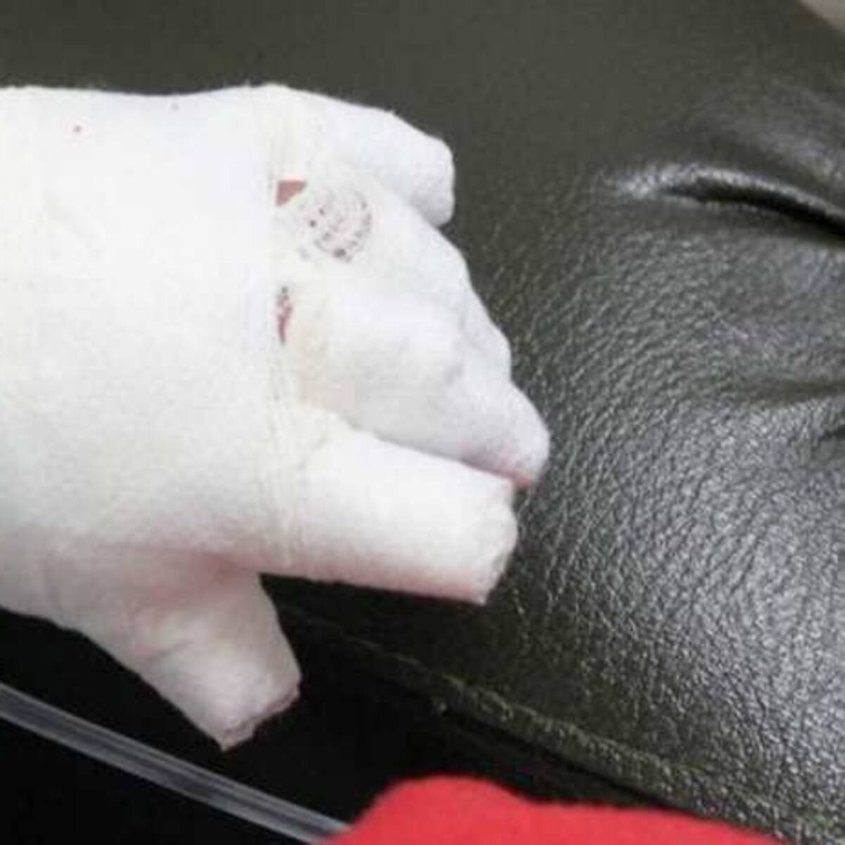 Mujer de 25 años lucha por su vida tras violento ataque en Neiva