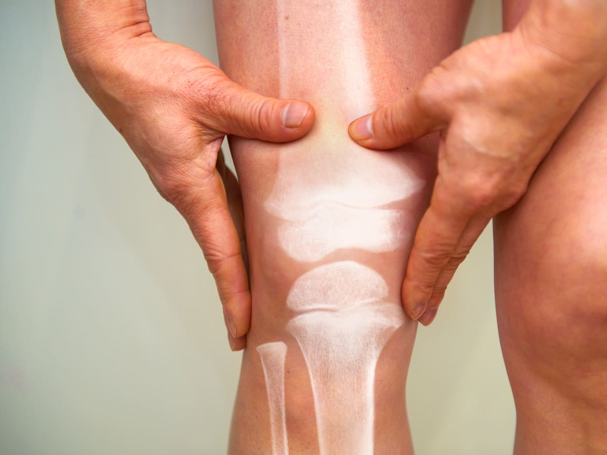 Educar al paciente sobre el dolor