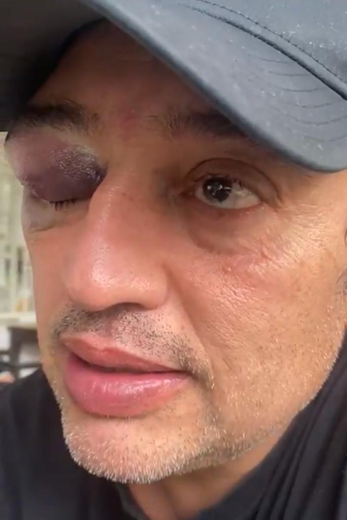 Hijo de Rodolfo Hernández denunció agresión por diferencias políticas