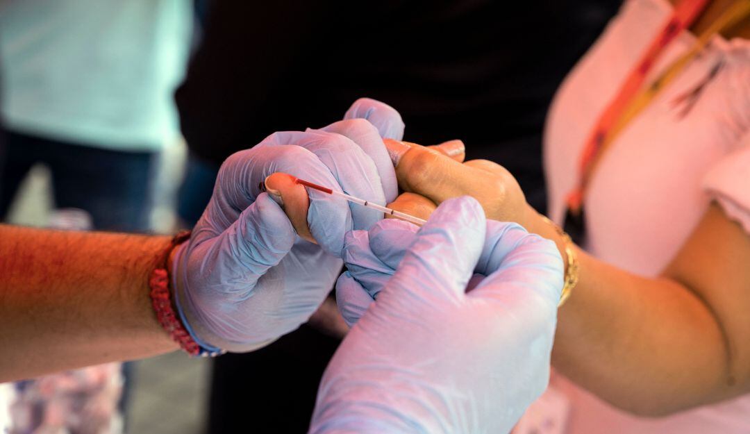 Toma de pruebas diagnóstico de VIH SIDA. 