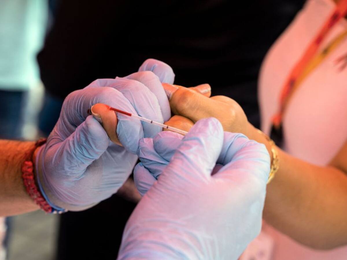 Descubren variante más virulenta y dañina del VIH en Países Bajos