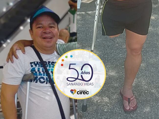 Soluciones W: Óscar volverá a caminar con apoyo de CIREC tras 21 años de vivir con discapacidad.