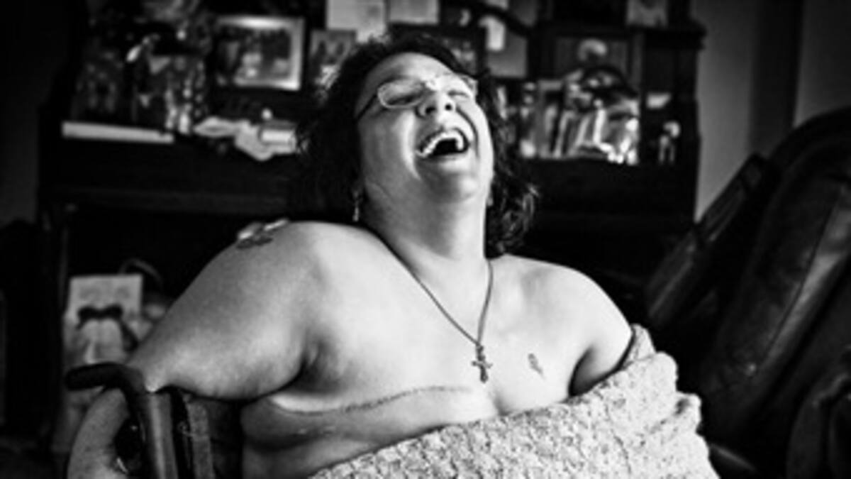 El verdadero impacto de una mastectomía